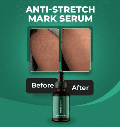 serum for strech marks